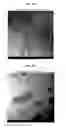 Fig. 07 - Compositions and methods for treating, including preventing, parvovirus infections and related diseases