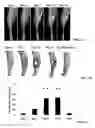 Fig. 02 - Anti-glucosaminidase passive immunization for infections