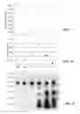 Fig. 04 - Anti-glucosaminidase passive immunization for infections