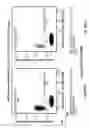 Fig. 124 - DEFINED COMPOSITION GENE MODIFIED T-CELL PRODUCTS