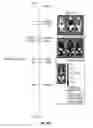 Fig. 86 - DEFINED COMPOSITION GENE MODIFIED T-CELL PRODUCTS