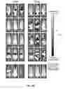 Fig. 87 - DEFINED COMPOSITION GENE MODIFIED T-CELL PRODUCTS