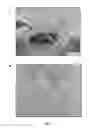 Fig. 02 - GENETICALLY MODIFIED MESENCHYMAL STEM CELLS THAT EXPRESS AN EXOGENOUS CYTOTOXIC PROTEIN