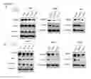 Fig. 06 - Dual targeting antisense oligonucleotides as apoptotic inhibtor therapeutic compostions and methods for their use in the treatment of cancer