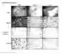 Fig. 15 - Dual targeting antisense oligonucleotides as apoptotic inhibtor therapeutic compostions and methods for their use in the treatment of cancer