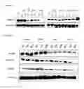 Fig. 19 - Dual targeting antisense oligonucleotides as apoptotic inhibtor therapeutic compostions and methods for their use in the treatment of cancer