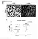 Fig. 24 - Dual targeting antisense oligonucleotides as apoptotic inhibtor therapeutic compostions and methods for their use in the treatment of cancer