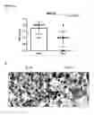 Fig. 25 - Dual targeting antisense oligonucleotides as apoptotic inhibtor therapeutic compostions and methods for their use in the treatment of cancer