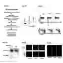 Fig. 07 - DDX5 AND ASSOCIATED NON-CODING RNAs AND MODULATION OF TH17 EFFECTOR FUNCTION