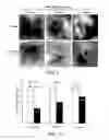 Fig. 07 - Pharmaceutical composition and method for reducing scar formation