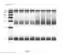 Fig. 09 - DETECTING INCREASE OR DECREASE IN THE AMOUNT OF A NUCLEIC ACID HAVING A SEQUENCE OF INTEREST