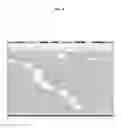 Fig. 05 - NOVEL ESTROGEN RECEPTOR MUTATIONS AND USES THEREOF