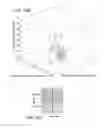 Fig. 27 - MiRNA expression signature in the classification of thyroid tumors