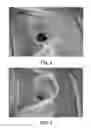 Fig. 03 - Methods for reducing deposits in ingot puller exhaust systems