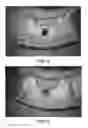 Fig. 04 - Methods for reducing deposits in ingot puller exhaust systems