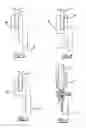 Fig. 05 - Single-rail window regulator assembly