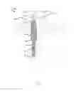 Fig. 02 - Centralizer for downhole probes