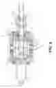 Fig. 07 - Gapless piston ring for internal combustion engine