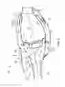 Fig. 03 - Combustor assembly for use in a gas turbine engine and method of assembling