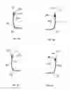 Fig. 03 - One-piece sheet-metal structure formed with clench locked corners
