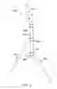 Fig. 07 - Support Apparatus