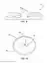 Fig. 08 - Method of fabricating micro-glassblown gyroscopes