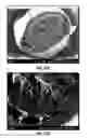 Fig. 22 - Flexible electrical devices and methods