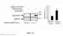 Fig. 07 - SCREENING TARGETS AND COMPOSITIONS AND METHODS FOR TREATMENT OF CILIOPATHY DISORDERS