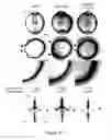 Fig. 43 - SCREENING TARGETS AND COMPOSITIONS AND METHODS FOR TREATMENT OF CILIOPATHY DISORDERS