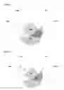 Fig. 02 - Qualitative predictive method for differential diagnosis of pneumococcal meningococcal and viral meningitis, method and kit for differential diagnosis of meningitis