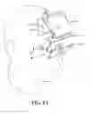 Fig. 15 - Head Mounted Display With Lens