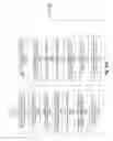 Fig. 29 - Apparatus and method for accurate barcode scanning using dynamic timing feedback