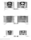 Fig. 06 - Face detection, augmentation, spatial cueing and clutter reduction for the visually impaired