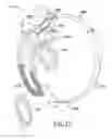 Fig. 20 - Face detection, augmentation, spatial cueing and clutter reduction for the visually impaired