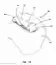 Fig. 04 - Simulated dissectible tissue