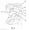 Fig. 07 - Simulated dissectible tissue