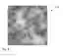 Fig. 04 - Method for automatic correction of astigmatism