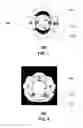 Fig. 03 - Dielectric transmission medium connector and methods for use therewith