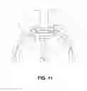 Fig. 12 - Brushless motor having terminal fixing blocks