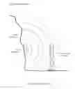 Fig. 12 - Eye mounted displays and systems, with headpiece