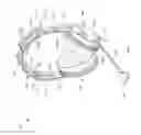 Fig. 02 - Headset with force isolation