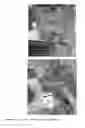 Fig. 06 - Method and system for surface and subsurface water retention