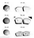 Fig. 05 - Plant-based egg substitute compositions