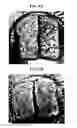 Fig. 11 - Plant-based egg substitute compositions