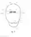 Fig. 04 - DEVICES, SYSTEMS AND METHODS RELATING TO DUST MASKS HAVING EAR PROTECTION