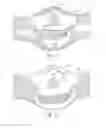 Fig. 08 - DEVICES, SYSTEMS AND METHODS RELATING TO DUST MASKS HAVING EAR PROTECTION