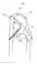 Fig. 01 - Protective apparel and support apparatus and method of use