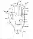 Fig. 01 - Patterned medical glove for use when taking a pulse
