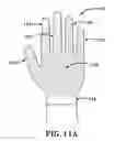 Fig. 09 - Patterned medical glove for use when taking a pulse