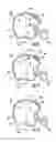 Fig. 06 - Headgear system with impact reduction feature